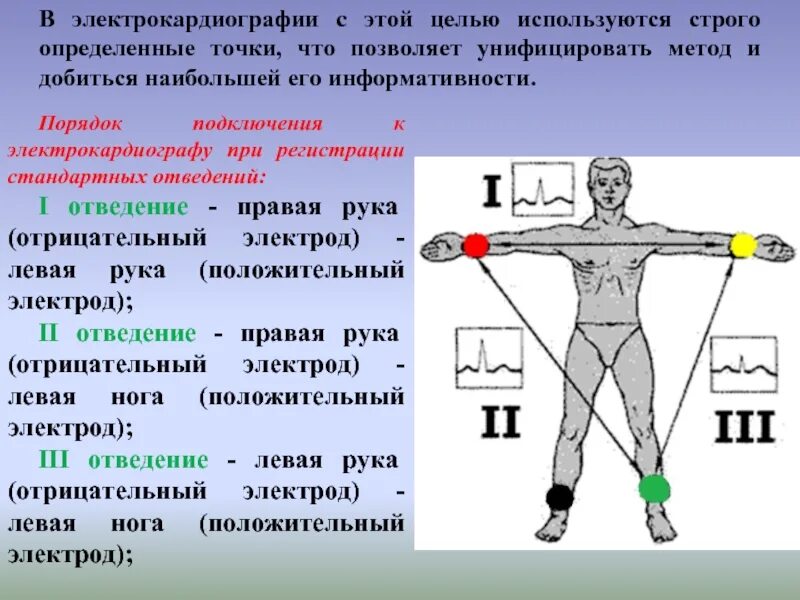 На левую руку при экг накладывают