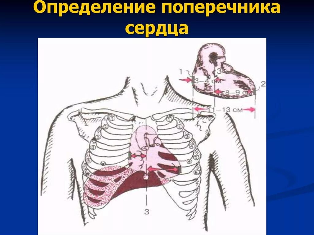 Размеры поперечника относительной тупости сердца. Поперечник относительной сердечной тупости. Длинник и поперечник сердца. Измерение длинника и поперечника сердца. Длинник и поперечник