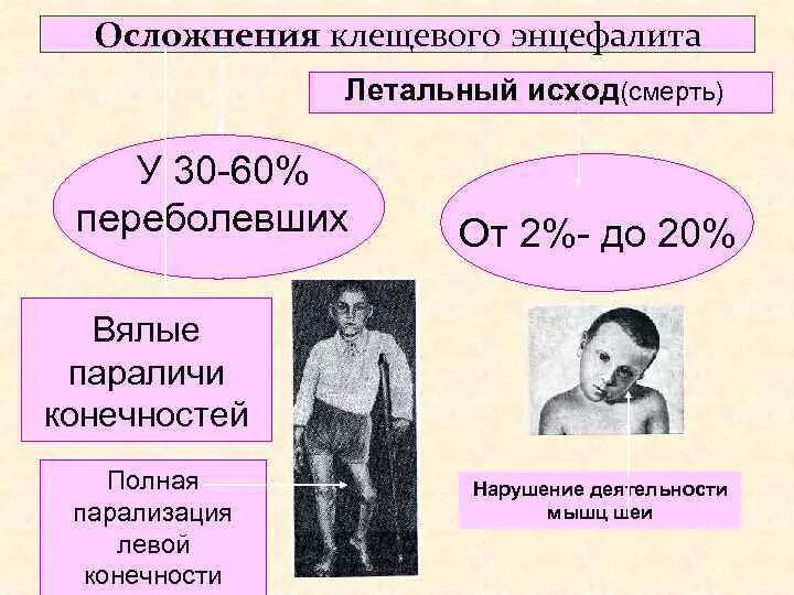 Энцефалит как заболевают. Последствия клещевого энцефалита. Осложнения клещевого энцефалита. Полиомиелитическая форма клещевого энцефалита.