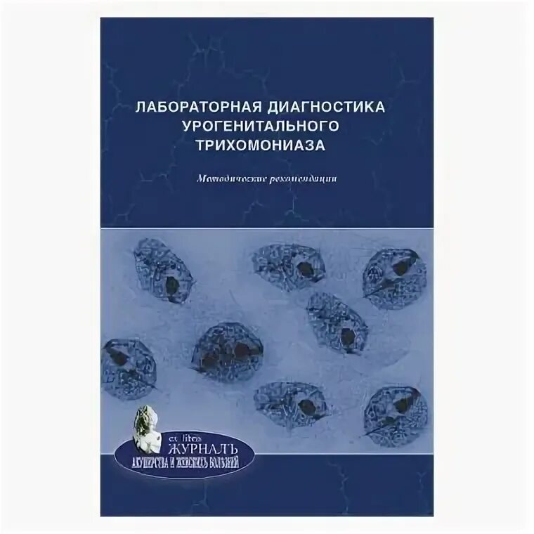 Трихомонада урогенитальная диагностика. Лабораторная диагностика урогенитального трихомониаза показана. Лабораторная диагностика урогенитального трихомониаза показана. Урогенитальный трихомониаз осложнения. Методы лабораторной диагностики трихомониа.