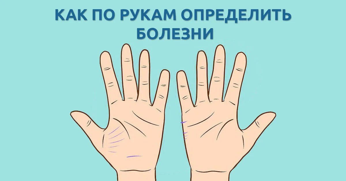 Kak po. Определение болезни по рукам. Болезни по ладони. Определение заболеваний по ладони. Болезни по ладоням рук.