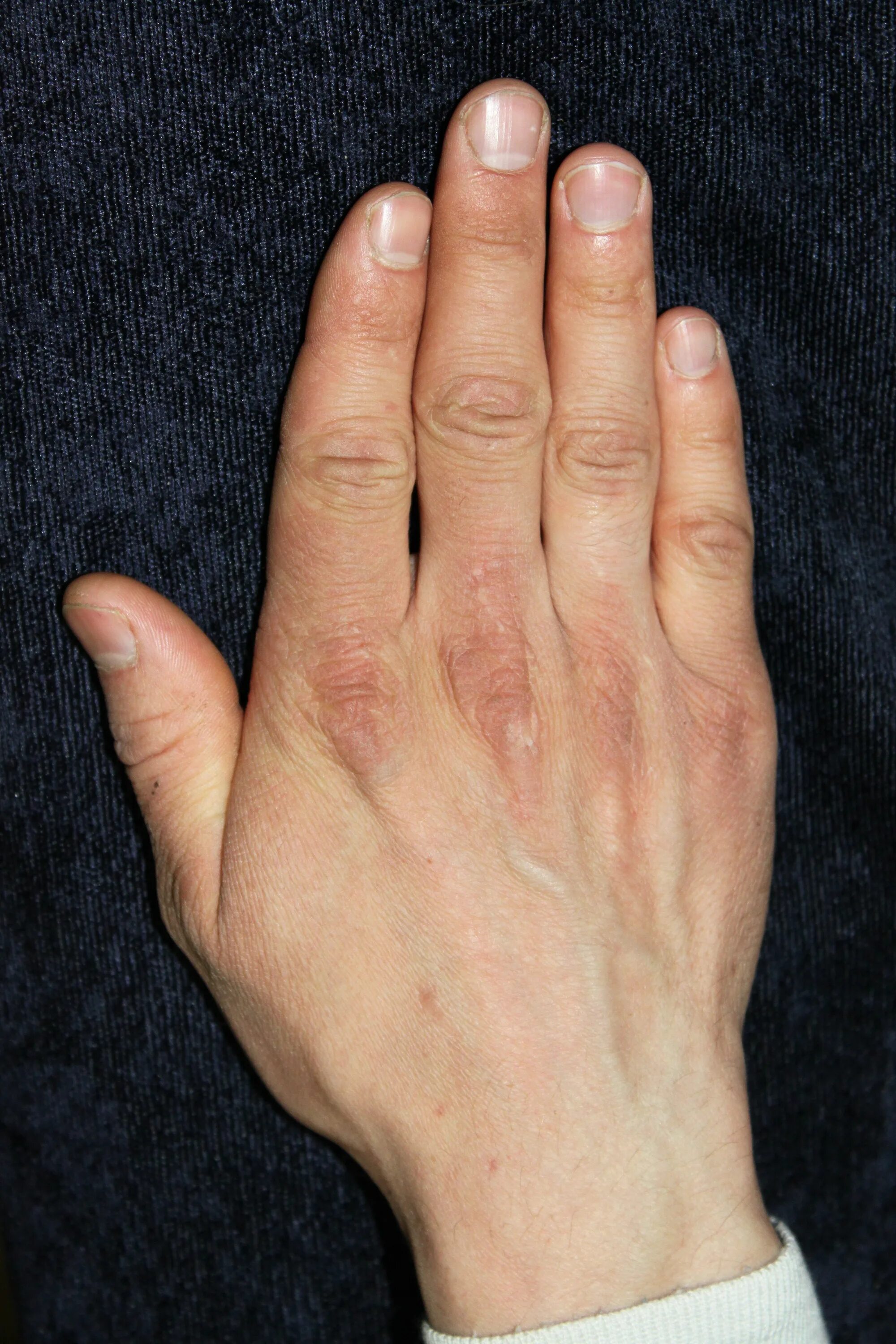 Мужские пальцы. Мужская рука. Лицевая сторона руки