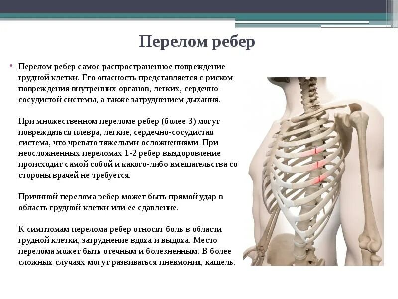 Перелом 6 ребра симптомы. Симптомы при перелома ребер грудной клетки.