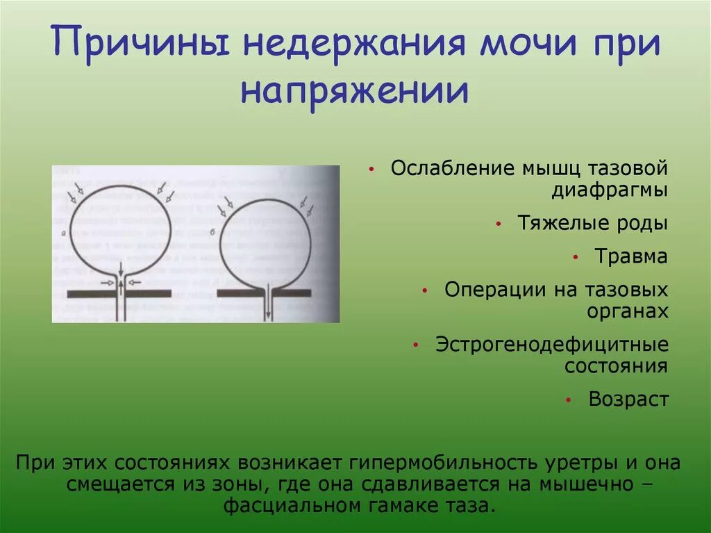 Почему происходит недержание