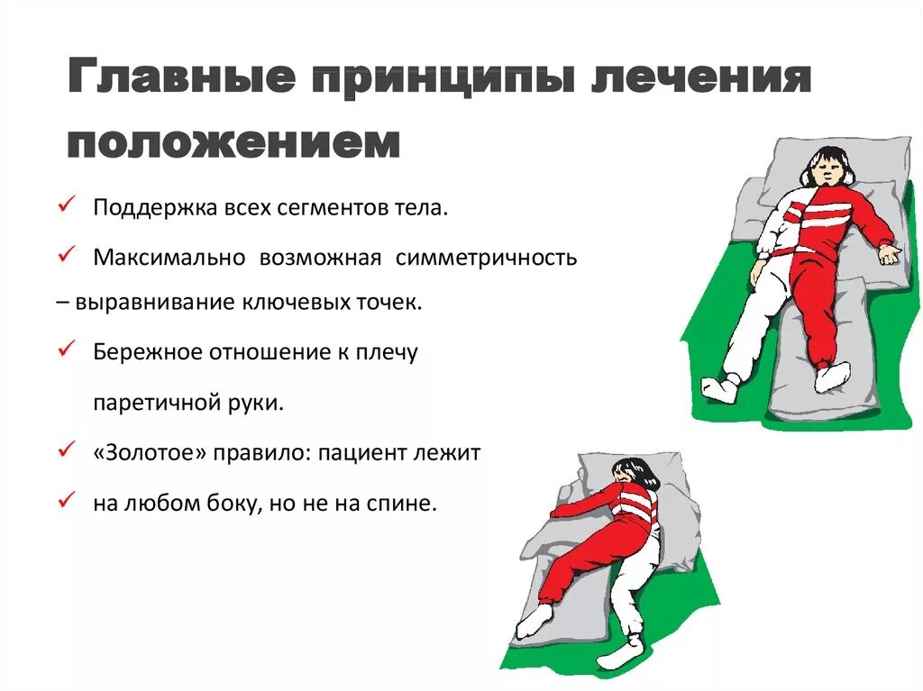 Положение после инсульта. Инсульт положение больного. лечение положением. инсульт позиционирование. положение больного после инсульта.