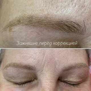 Перед коррекцией