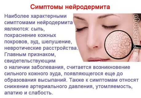 Признак воспаления кожи