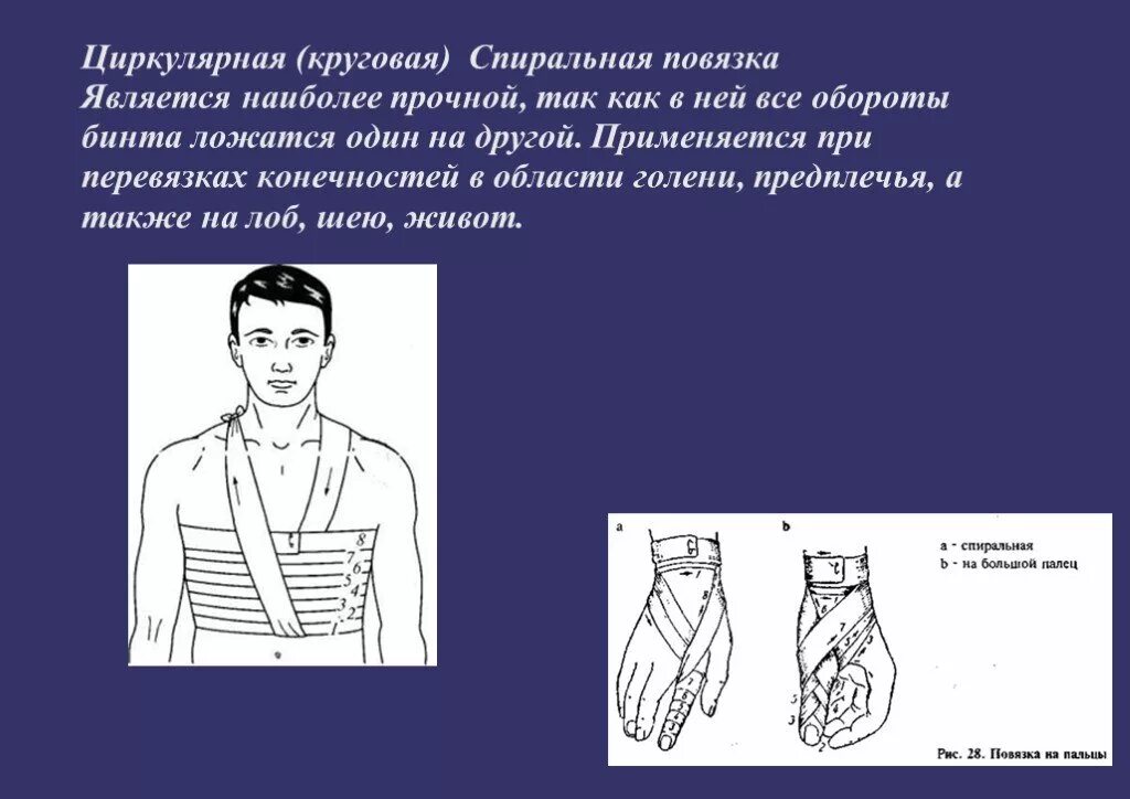 Спиральная повязка техника наложения. Спиральная и циркулярная повязка. Спиральная повязка циркулярная повязка. Циркулярная круговая повязка. Циркулярная бинтовая повязка.