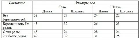 Мало матка