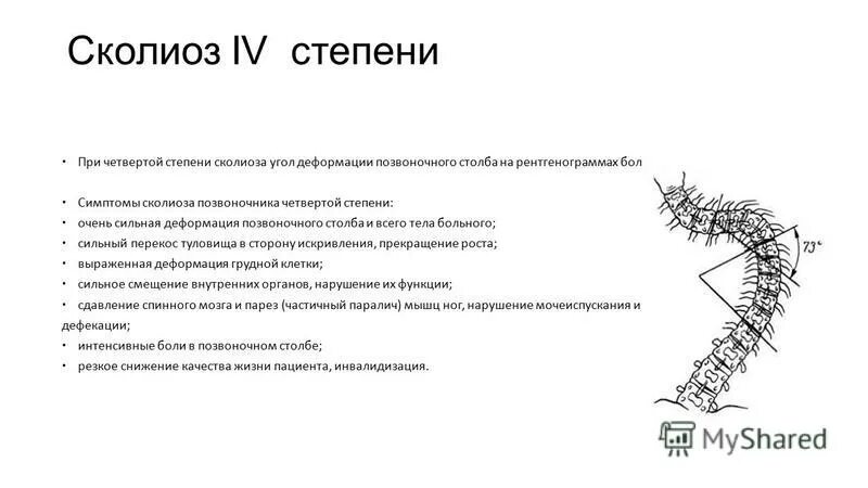 Д. Сколиоз 4 степени рентген. Степень сколиотической деформации. Степени сколиоза позвоночника по чаклину. Степень сколиотической деформации.