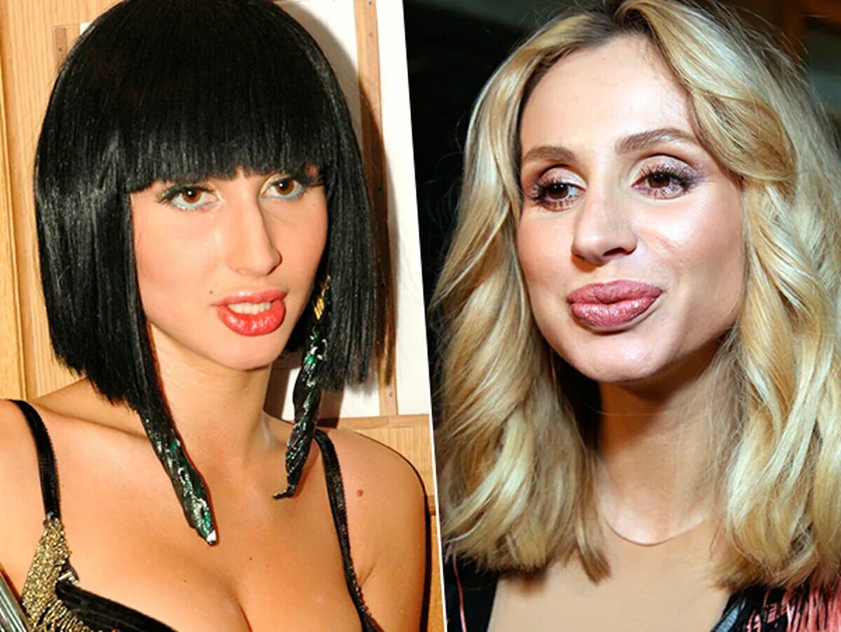 оксана самойлова до пластики. жена сделала губы. жена сделала губы. кристина рей до пластики. юлия волкова после пластики.