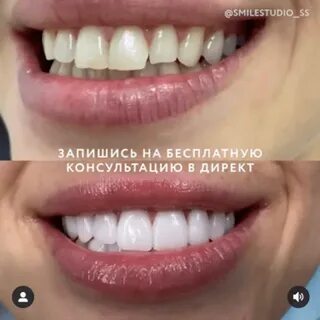 Улыбка 15