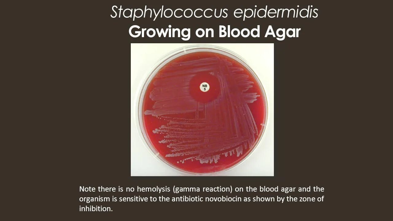 Staphylococcus epidermidis что это. Гемолиз стафилококка эпидермального. staphylococcus epidermidis гемолиз. симптомы эпидермального стафилококка. передачи эпидермального стафилококка.