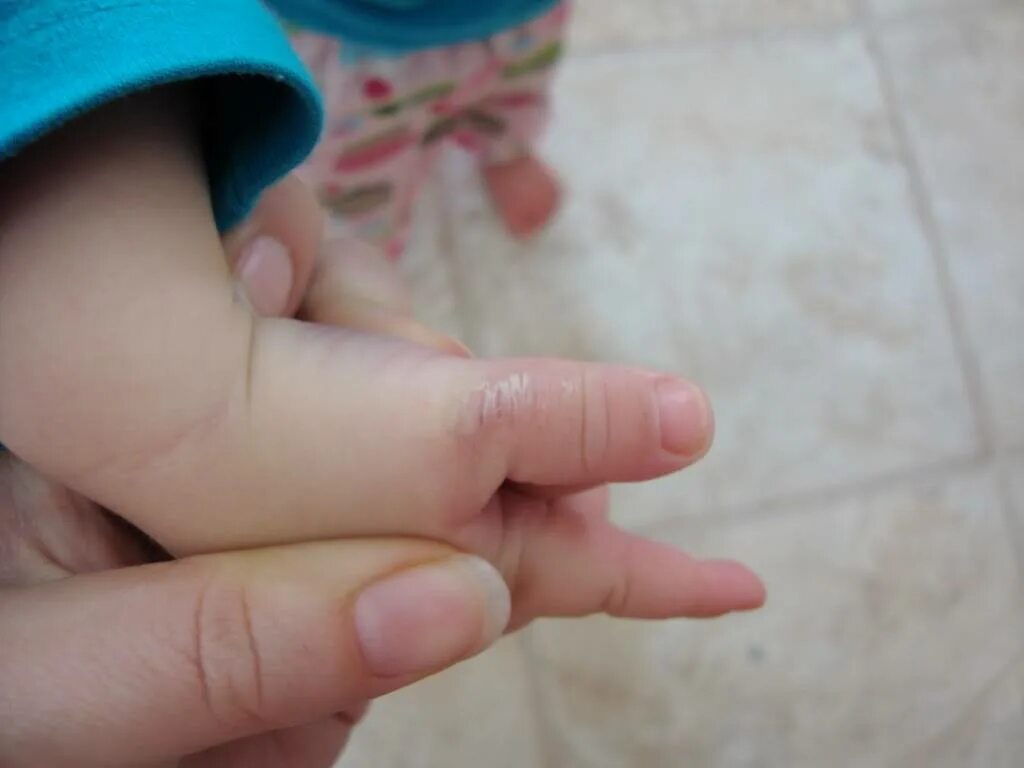 Про пальчики для малышей. Ребёнок руки пальцы большой. Отсасывать палец