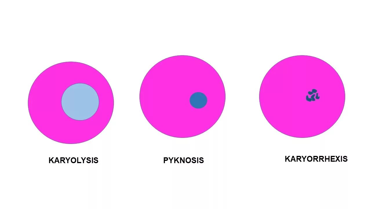 Кариопикноз это. Кариопикноз кариорексис кариолизис некроз. Иллюстрация кариопикноз. Cell injury.
