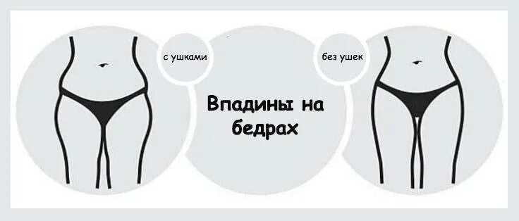 Впадинки на бедрах. Ямки на бедрах. Впадины на боках бедер. Ямка между бедрами и боками. Как убрать ямочки на ягодицах