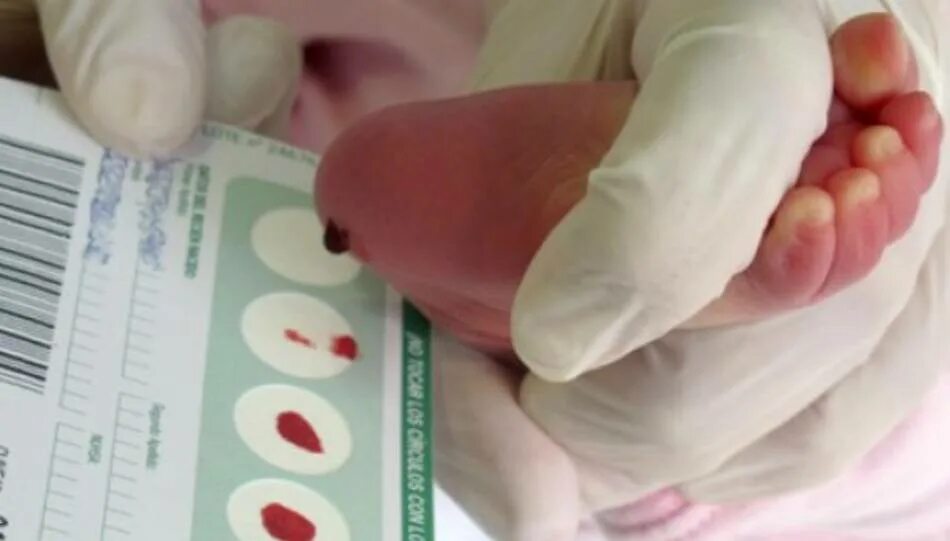 Скрининг новорожденного 2023. Неонатальный скрининг новорожденных заболевания. Неонатальный скрининг список заболеваний. Скрининг новорожденного 2023. Скрининг новорожденного 2023.