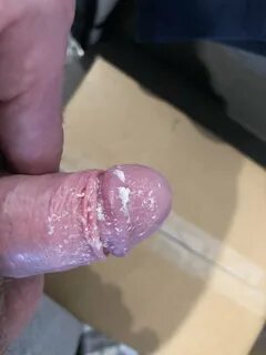 Slideshow Smegma Blowjob.