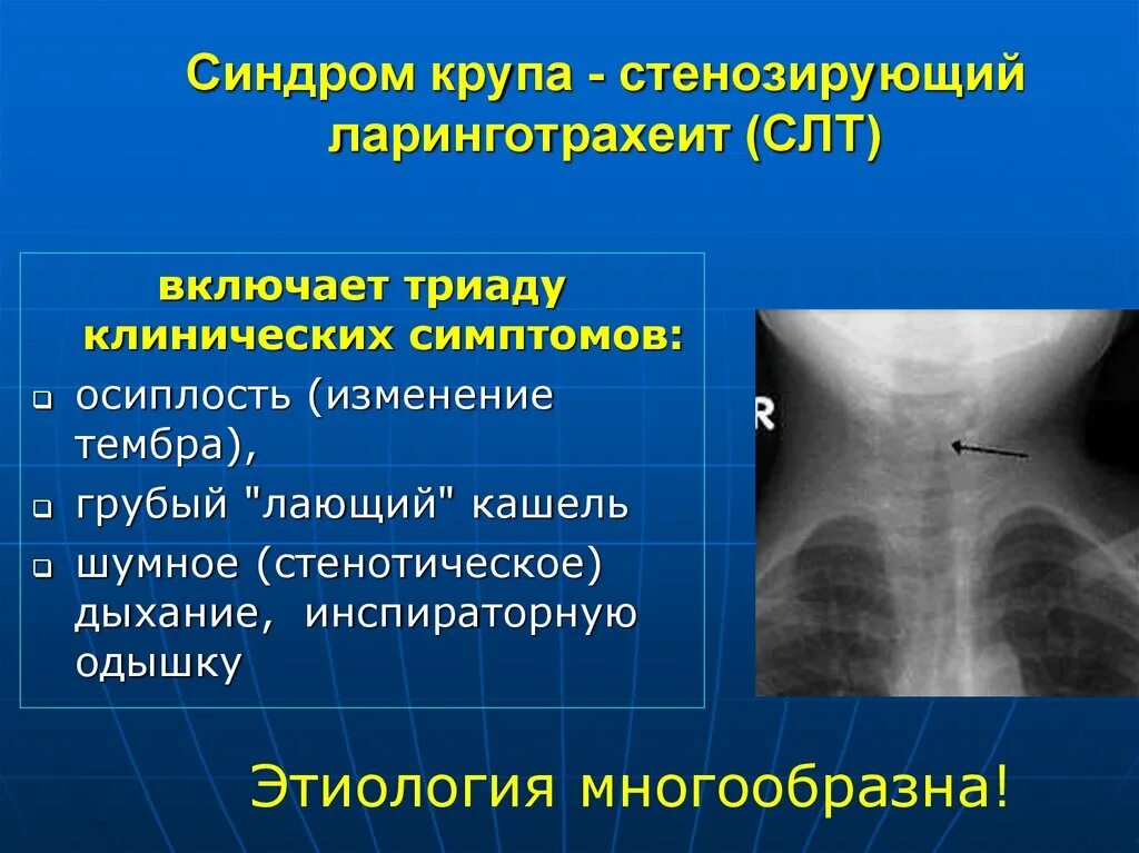 Стенозирующее образование. Стенозирующее образование