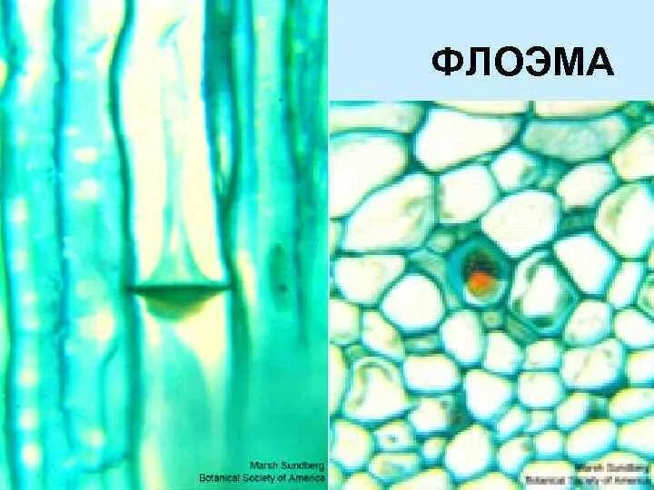 Ситовидные трубки флоэмы под микроскопом. Флоэма ткани растений. Ксилема и флоэма это ткани. Флоэма растений под микроскопом. Клетки ксилемы и флоэмы