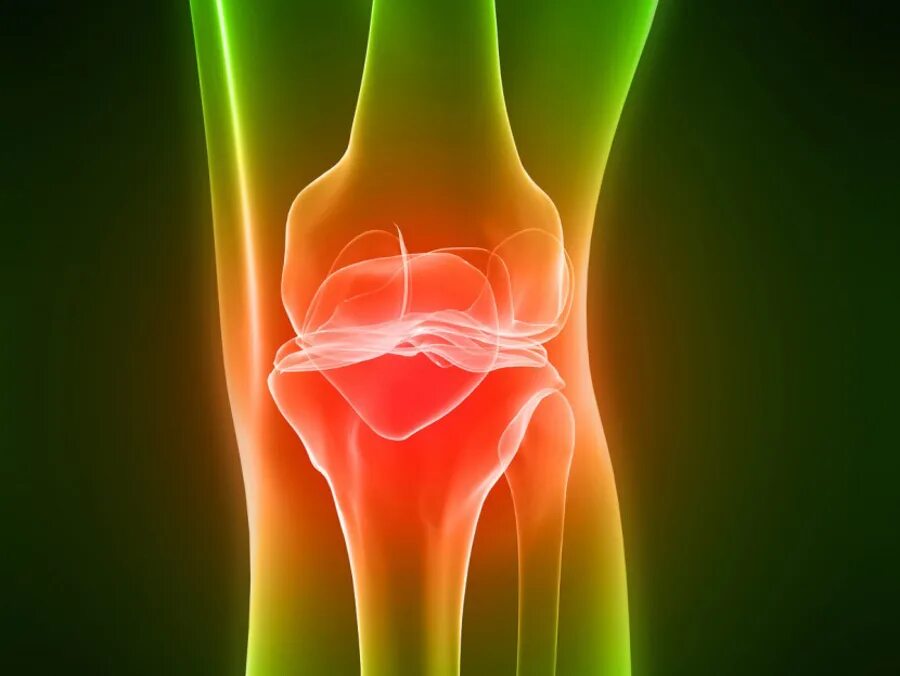 Хондроз коленного сустава. Остеохондроз коленного сустава. Лигаментоз коленного сустава. Артрозо-артрит коленного сустава.