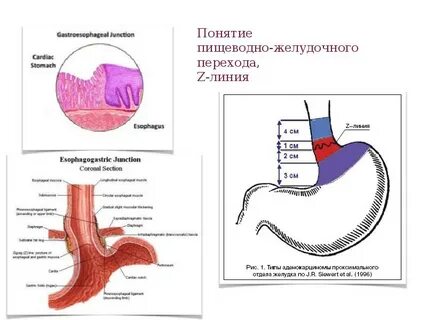 Зубчатая линия желудка