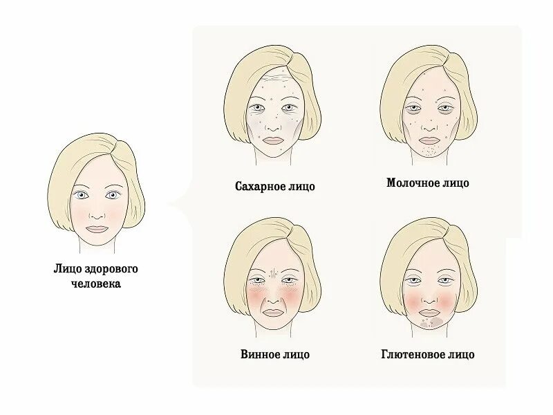 Портит какое лицо. Молочное сахарное глютеновое и винное лицо. Сахарное лицо. Винное лицо. Винное л ЦО.