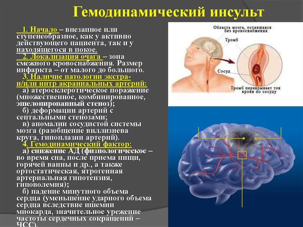 Инфаркт мозга причины. Ишемический инсульт очаг поражения. Очаг поражения при ишемическом инсульте. Ишемический инсульт атеротромботический клиника.