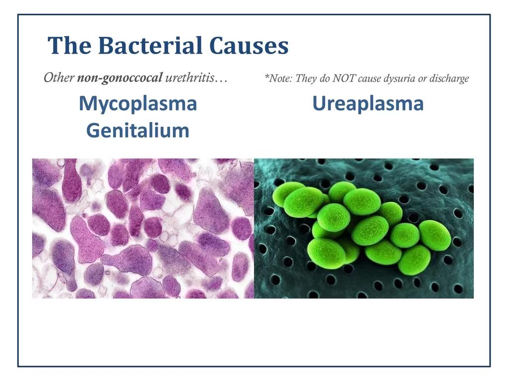 Mycoplasma hominis полукол днк