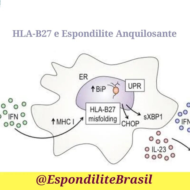 Hla b27 где сдать. Антиген hla b27. hla 27. mhc 1 и hla b 27.