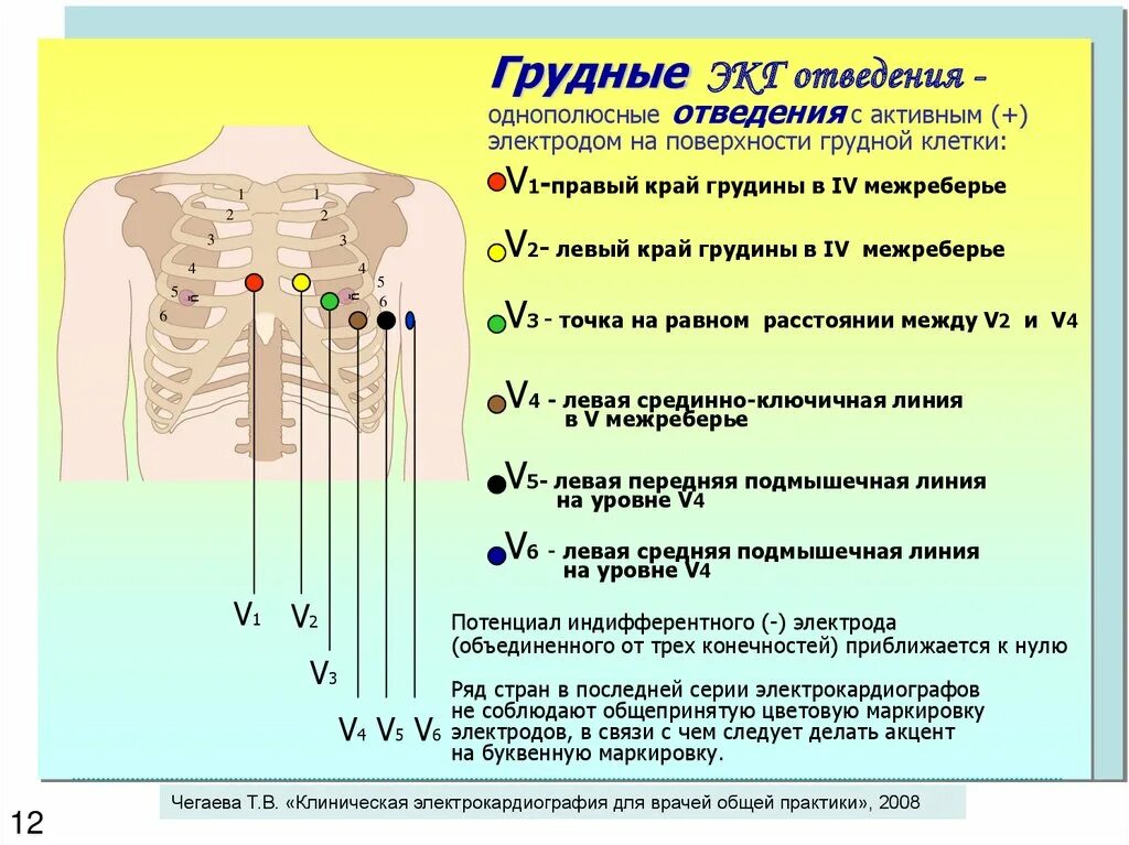 ЭКГ постановка электродов алгоритм. Алгоритм техники снятия ЭКГ. ЭКГ алгоритм выполнения манипуляции. Техника снятия ЭКГ алгоритм манипуляции. В каких условиях необходимо проводить исследование экг