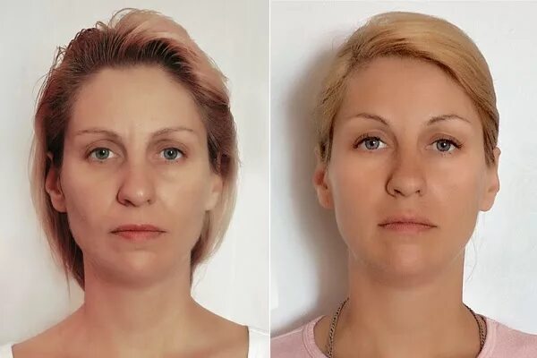 Око возрождения до и после. Око возрождения фото практикующих до и после. Око возрождения до и после. Око возрождения до и после. Око возрождения до и после.