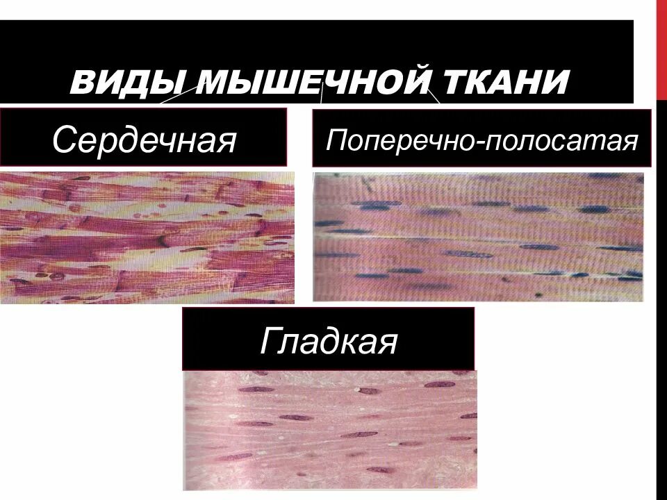 Отличие гладкой и поперечно полосатой ткани. Виды мышечной ткани. Гладкая и поперечно полосатая мышечная ткань. Поперечно-полосатая сердечная мышечная ткань. Гладкая мышечная ткань строение.