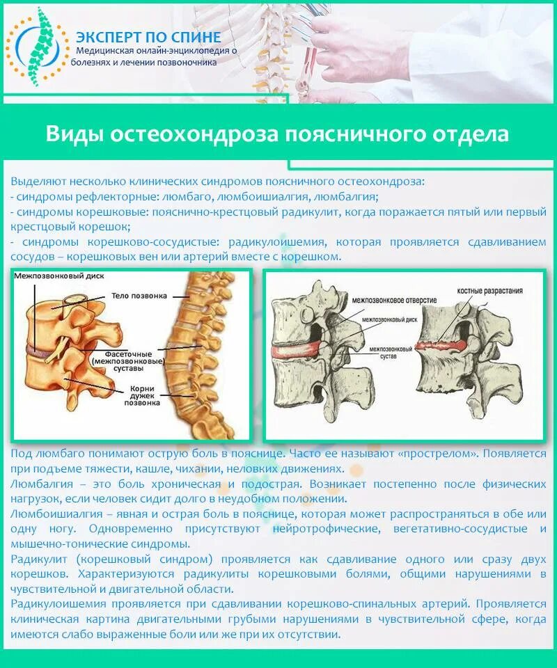 Хроническая боль в пояснице. Остеохондроз 4 степени поясничного отдела симптомы. Остеохондроз пояснично-крестцового отдела позвоночника. Остеохондроз пояснично-крестцового отдела шейного и грудного отдела. Хронический хондроз поясничного отдела.