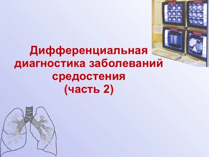 Диагностика средостения. Болезни средостения классификация. Лучевая диагностика органов средостения. Опухоли органов средостения. Диагностика средостения.