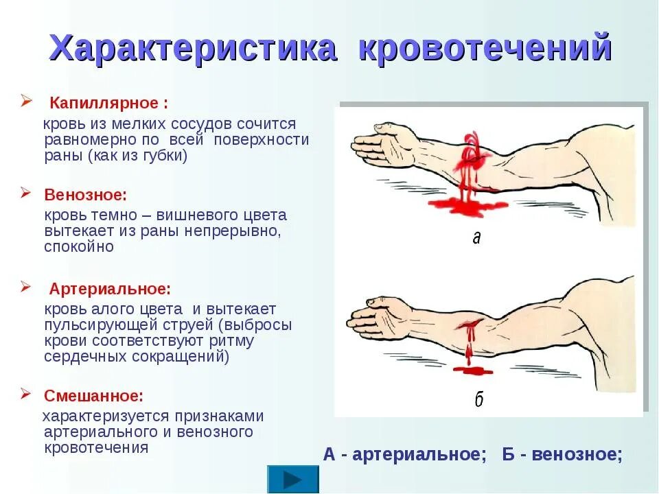 Внешней стороне с помощью