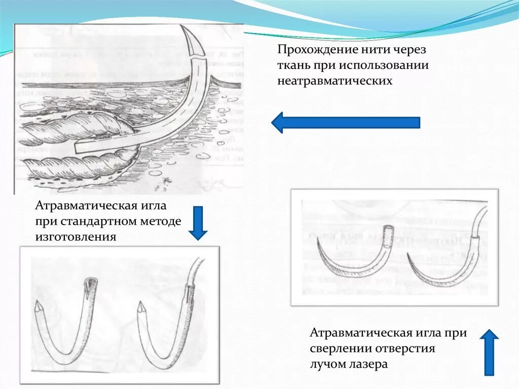 Атравматические нити с иглой. Атравматическая хирургическая игла. Травматические и атравматические иглы. Атравматические иглы в хирургии. Атравматичные нити в хирургии.