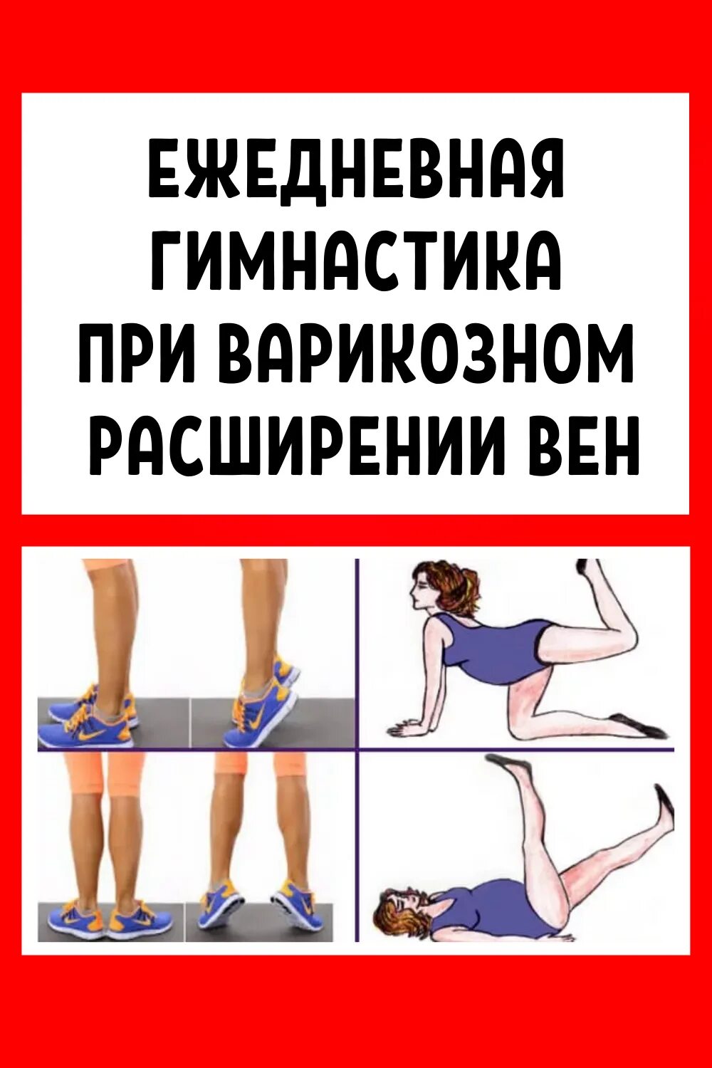 Упражнения притварикозе. Упражнения от варикоза на ногах. Упражнения при варикозе нижних конечностей.