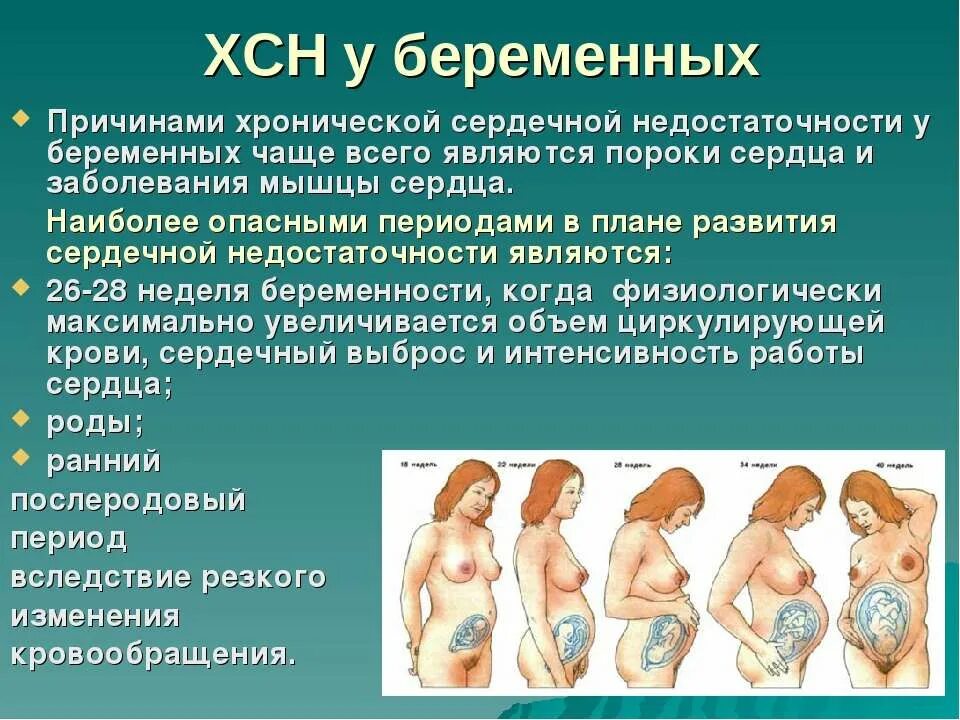 Беременность и сосудистые заболевания. Беременность при сердечной недостаточности. Сердечная недостаточность у беременных. Ведение беременности при ХСН.