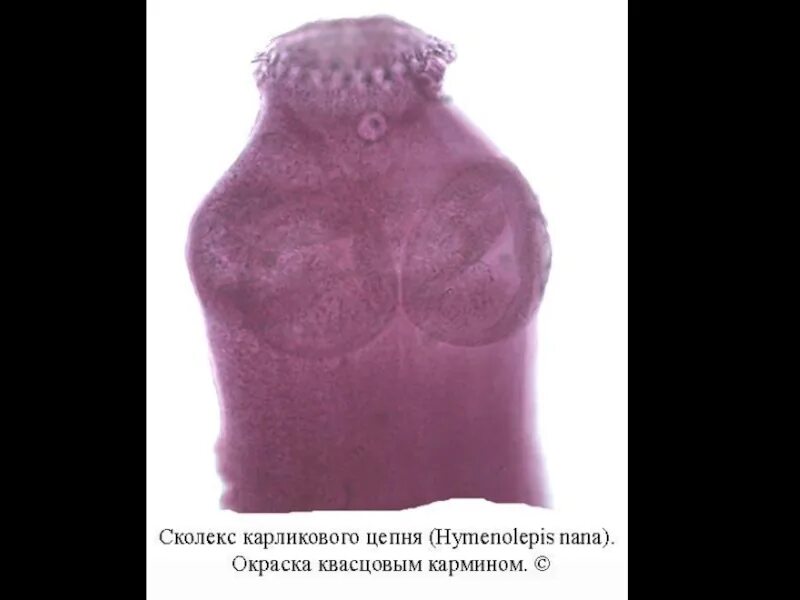 Зрелый членик бычьего цепня препарат. Стробил ленточные черви. Бычий цепень диагностика. Строение членика карликового цепня. Карликовый цепень инвазионная стадия.