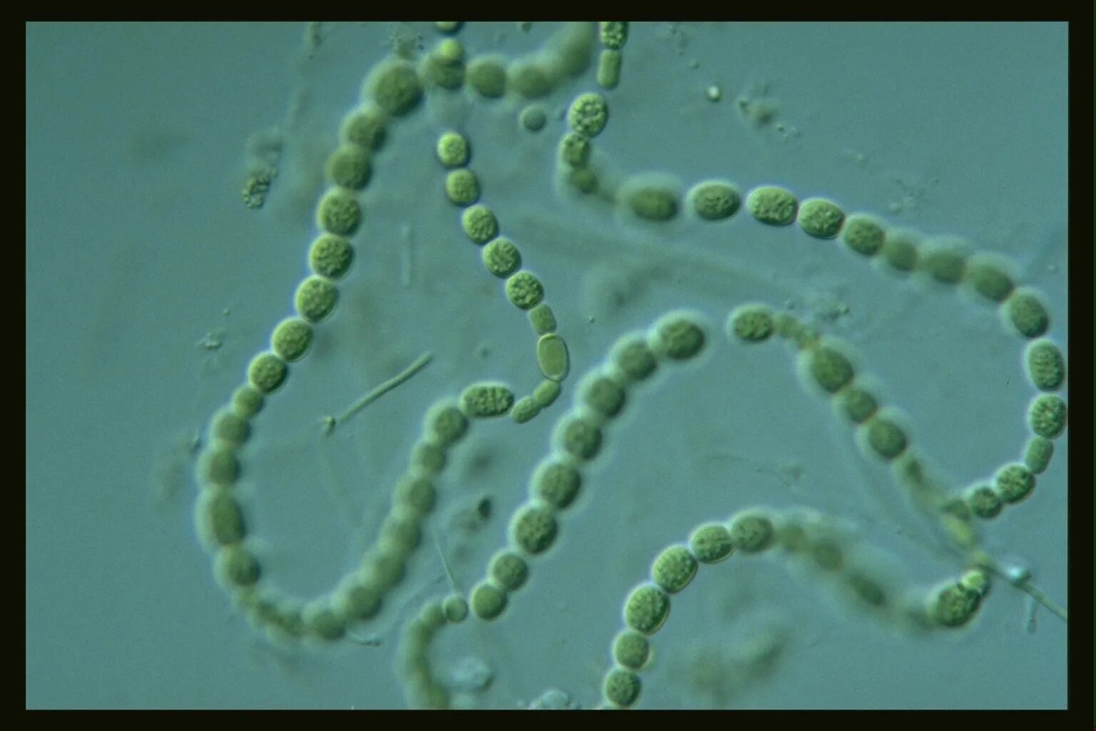 Строение клетки цианобактерий. Синезеленая водоросль спирулина. Носток водоросль. Цианобактерии какие водоросли. Цианобактерии какие водоросли.