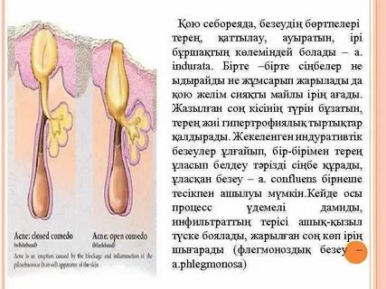 Менің анусымда безеу пайда болды (фото)