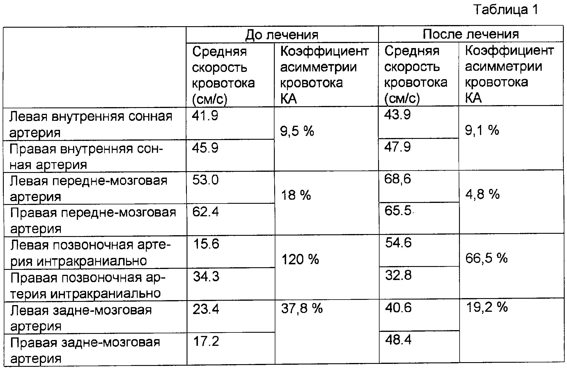Асимметрия кровотока d s. Норма кровотока по позвоночным артериям. асимметрия кровотока по позвоночным артериям в норме. коэффициент асимметрии кровотока. показатели скорости кровотока по позвоночным артериям.