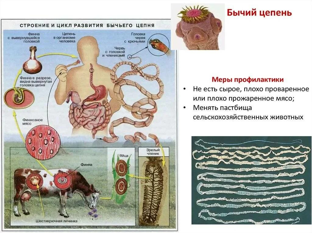 Симптомы цепня у человека. Бычий цепень поражаемые органы человека. Червь бычий цепень профилактика. Гельминтология бычий цепень. Бычий цепень цистицерк.