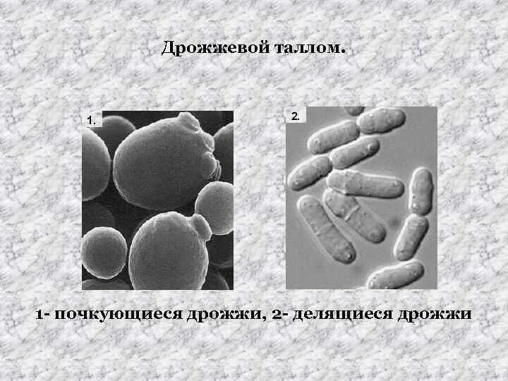 Оборудование для изучения клеток дрожжевых грибов. Дрожжеподобный таллом. Дрожжеподобный таллом у грибов. Почкующиеся дрожжи. Пекарские дрожжи под микроскопом.