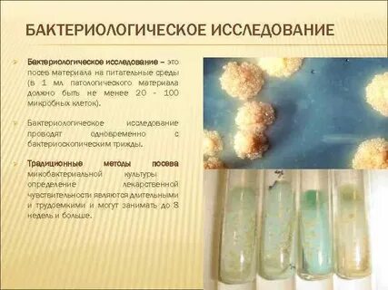 Обязательному бактериологическому исследованию