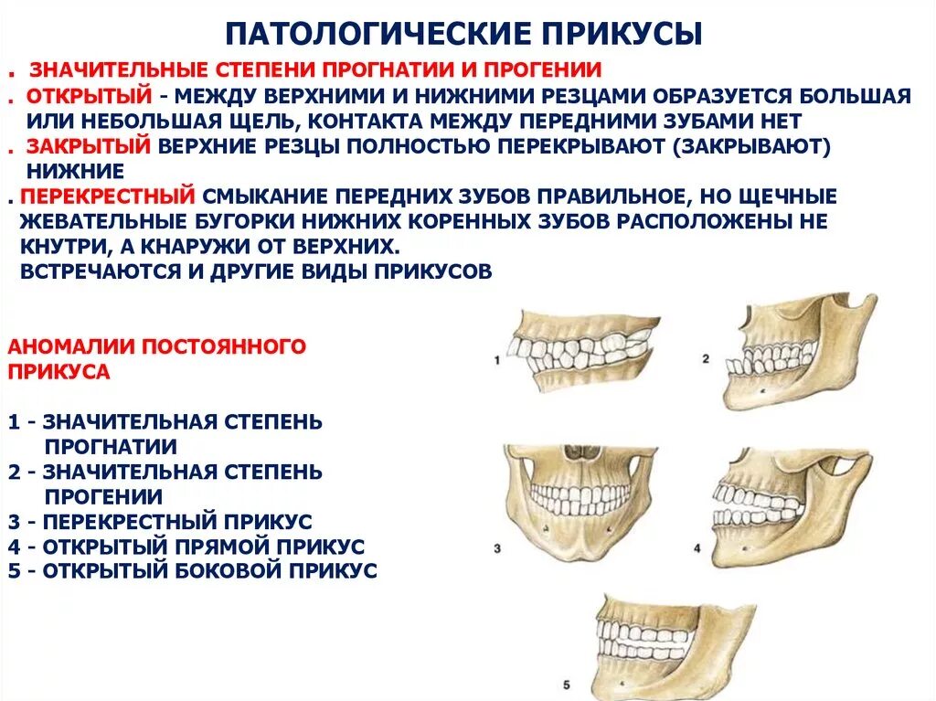 Основным признаком возрастных изменений костей. Прикусы физиологические и патологические. Строение челюсти прогения прогнатия. Ортогнатический прикус резцы.
