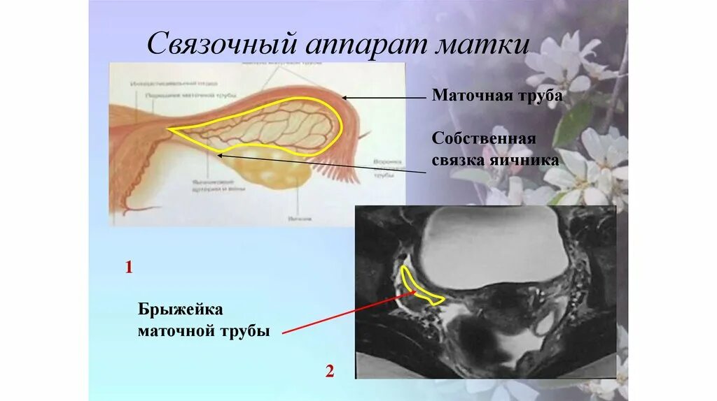 Кардинальная связка матки. Яичники маточные трубы и связочный аппарат это. Связочный аппарат малого таза. Связочный аппарат матки. Собственная связка яичника.