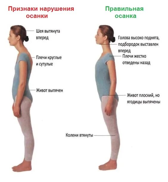 Проверьте правильно ли. Правильная осанка у человека. Основы правильной осанки. Идеальная осанка. При правильной осанке.