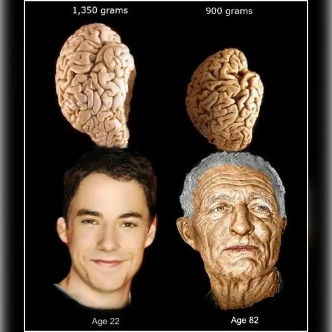 Возрастные изменения мозга. Старение мозга. Мозг в старости. Мозг пожилого человека.